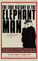 The True History of the Elephant Man