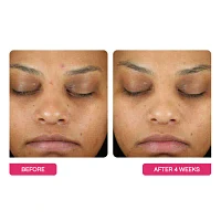 Beautystat Universal Triple Action Peel Pads 10 Pack