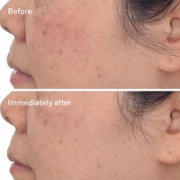 Murad Correct & Protect Serum Broad Spectrum Spf 45