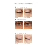 Murad Vita C Dark Circle Corrector Eye Cream