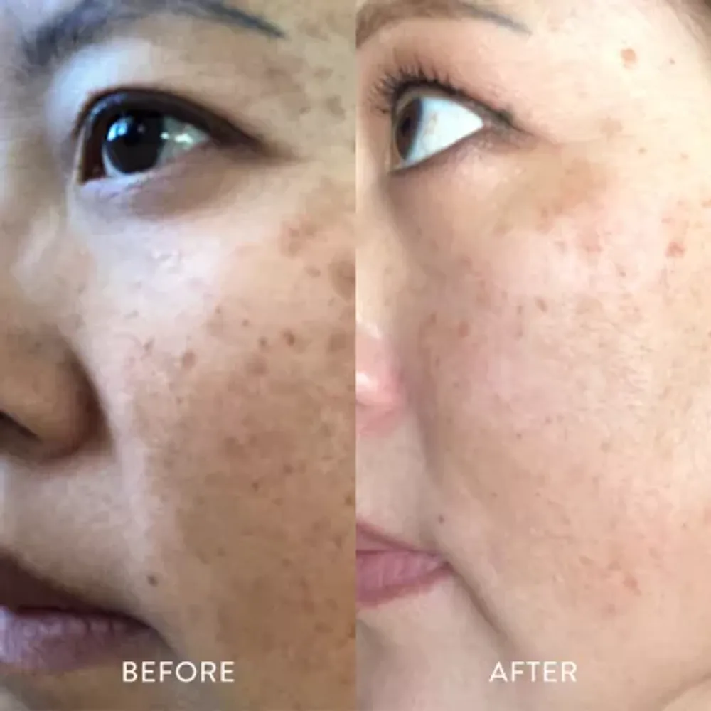 Pure Culture Custom Moisturizer& Serum+Skin Test Kit ($81 Value)