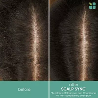 Biolage Scalp Sync Anti-Dandruff Shampoo - 33.8 oz.