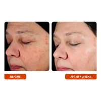 Beautystat Universal C Skin Refiner
