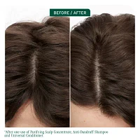 Biolage Scalp Sync Anit-Dandruff Shampoo 13.5 oz.