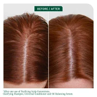 Biolage Scalp Sync Clarifying Shampoo 13.5 oz.