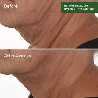 Murad Retinal Resculpting Overnight Treatment Facial Treatments