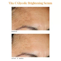 Murad Vita-C Glycolic Brightening Serum