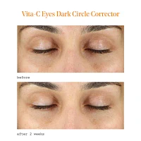 Murad Vita C Dark Circle Corrector Eye Cream