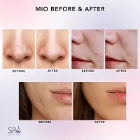 Spa Sciences Mio Microdermabrasion And Pore Extraction Skin Resurfacing System