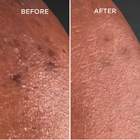 Ustawi Niacinamide Dark Spot Corrector Face Treatments