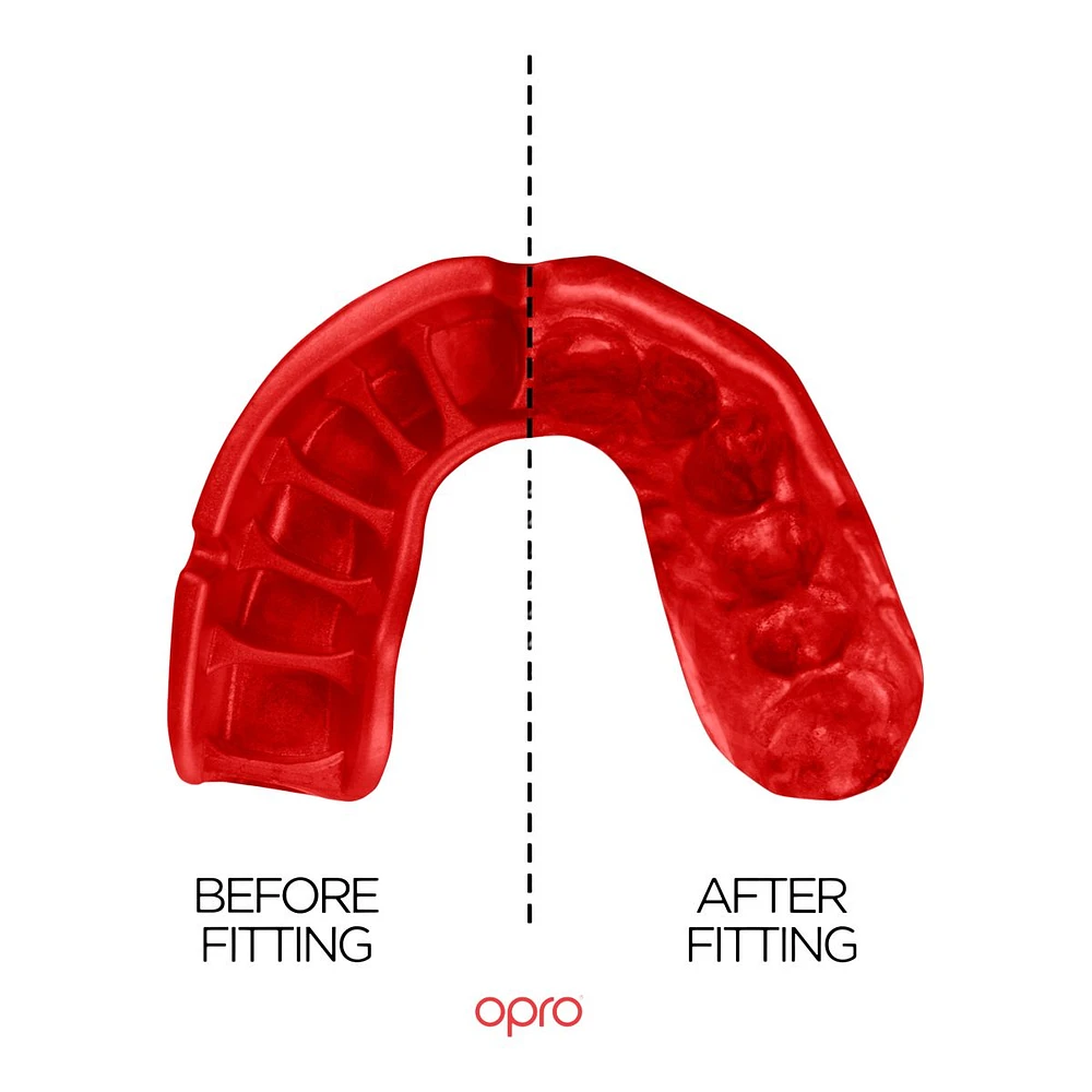 OPRO Self-Fit Platinum Mouthguard