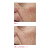 Bye Bye Redness Neutralizing Color-Correcting Concealer Cream