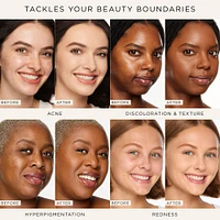 Shape Tape Concealer - 22N Light Neutral