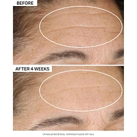 Advanced Retinol Nightly Renewal Moisturizer