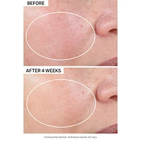 Advanced Retinol Nightly Renewal Moisturizer