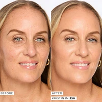 Shape Tape Radiant Concealer - 35H Medium Honey