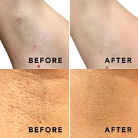 Buff & Brighten Ingrown Hair Treatment Spray - 1.69 oz