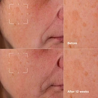 Even Better Clinical Dark Spot Clearing Serum with Vitamin C