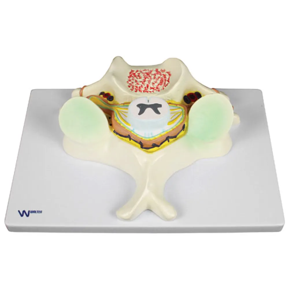 Walter Products 5th Cervical Vertebrae Model