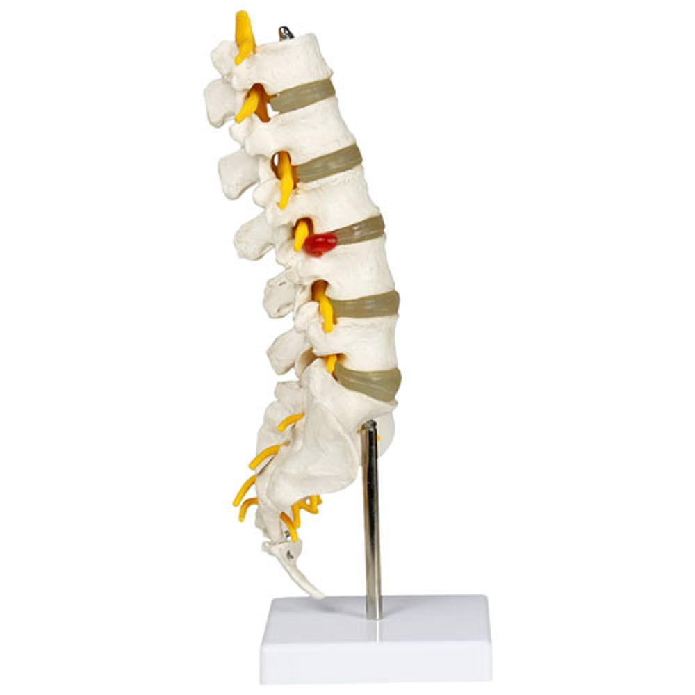 Walter Products 28cm Lumbar Spinal Column Model