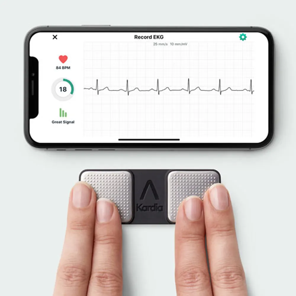 AliveCor KardiaMobile Personal EKG Monitor - AC-009-UA-C (Black