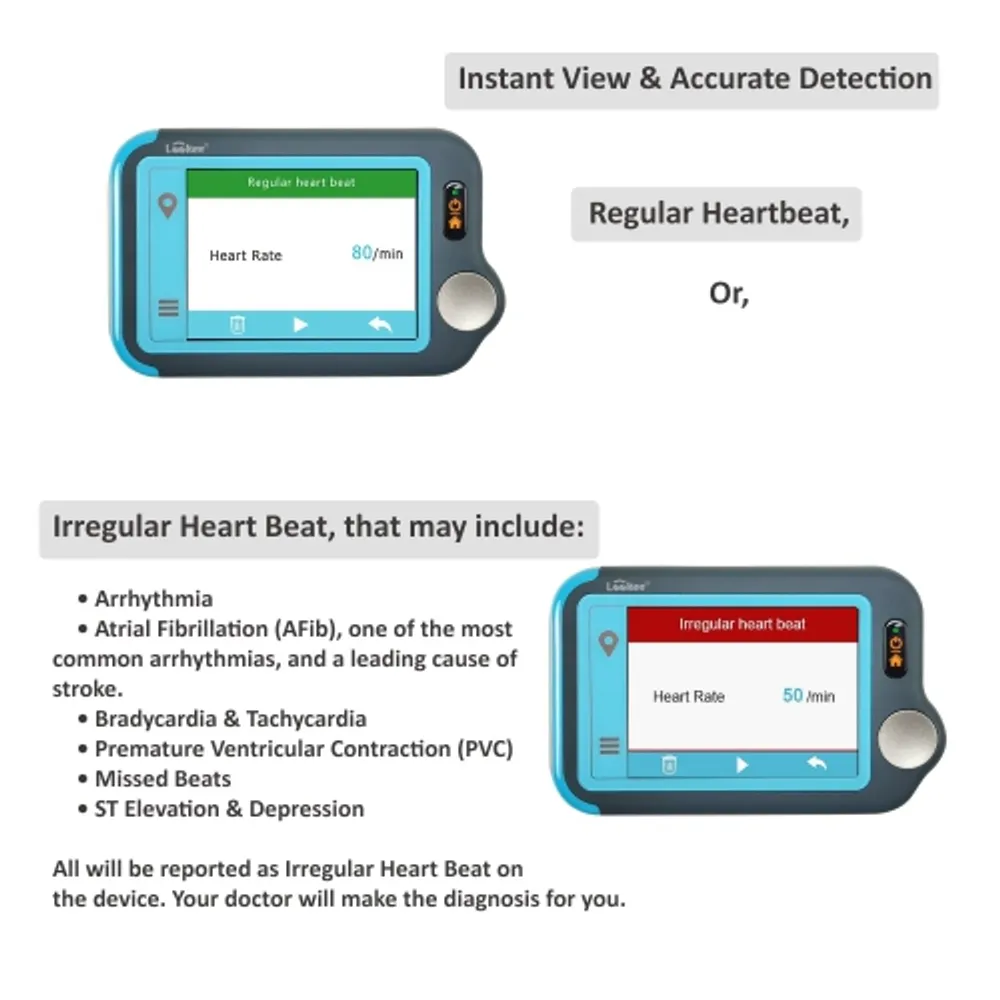 AliveCor KardiaMobile Personal EKG Monitor - AC-009-UA-C (Black