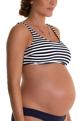 Pez D'Or Alba Stripe Maternity Bikini Top at Nordstrom,