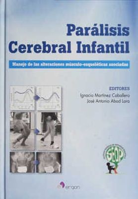 Parálisis cerebral infantil