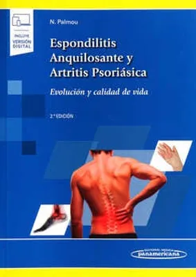 Espondilitis anquilosante y artritis psoriásica