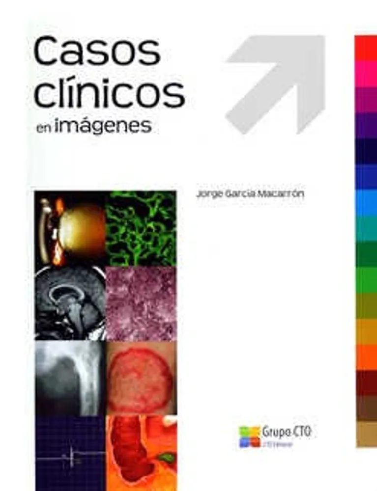 Casos clínicos en imágenes