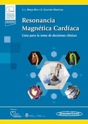 Resonancia magnética cardiaca