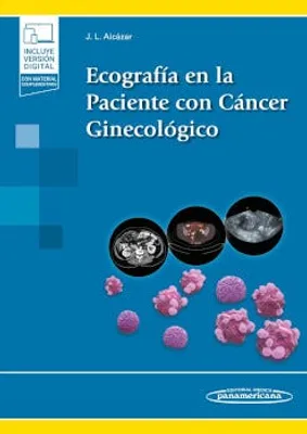 Ecografía en la paciente con cáncer ginecológico