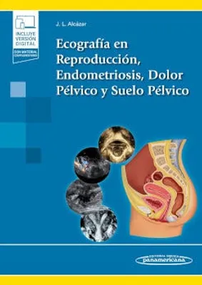 Ecografía en reproducción, endometriosis, dolor pélvico y suelo pélvico