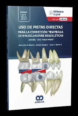 Uso de pistas directas para la corrección temprana de maloclusiones esqueléticas + e-book gratuito