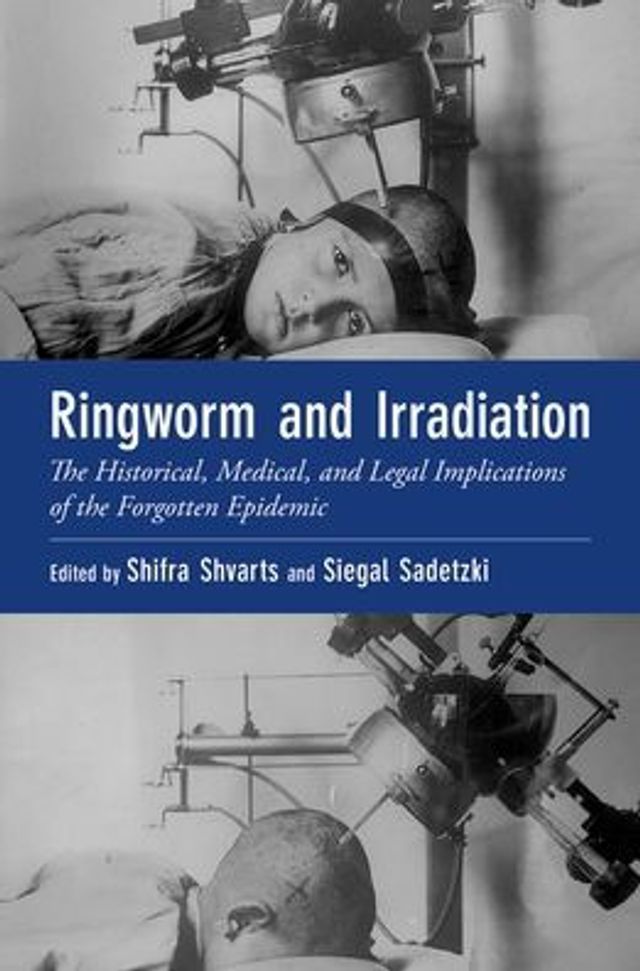 Ringworm and Irradiation: the Historical, Medical, Legal Implications of Forgotten Epidemic