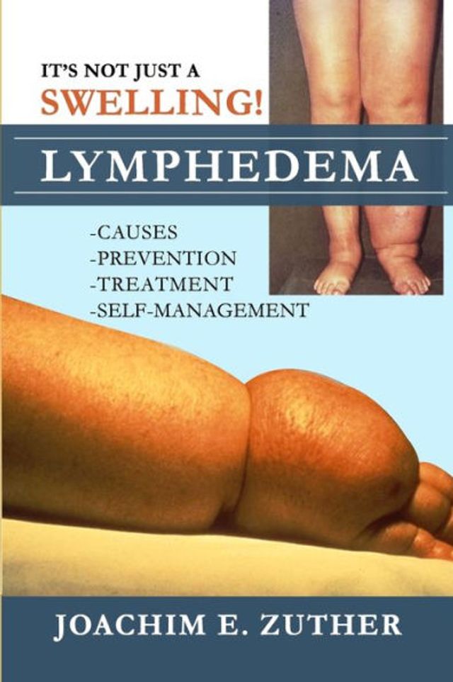 It's Not Just a Swelling! Lymphedema: Causes, Prevention, Treatment, Self-Management