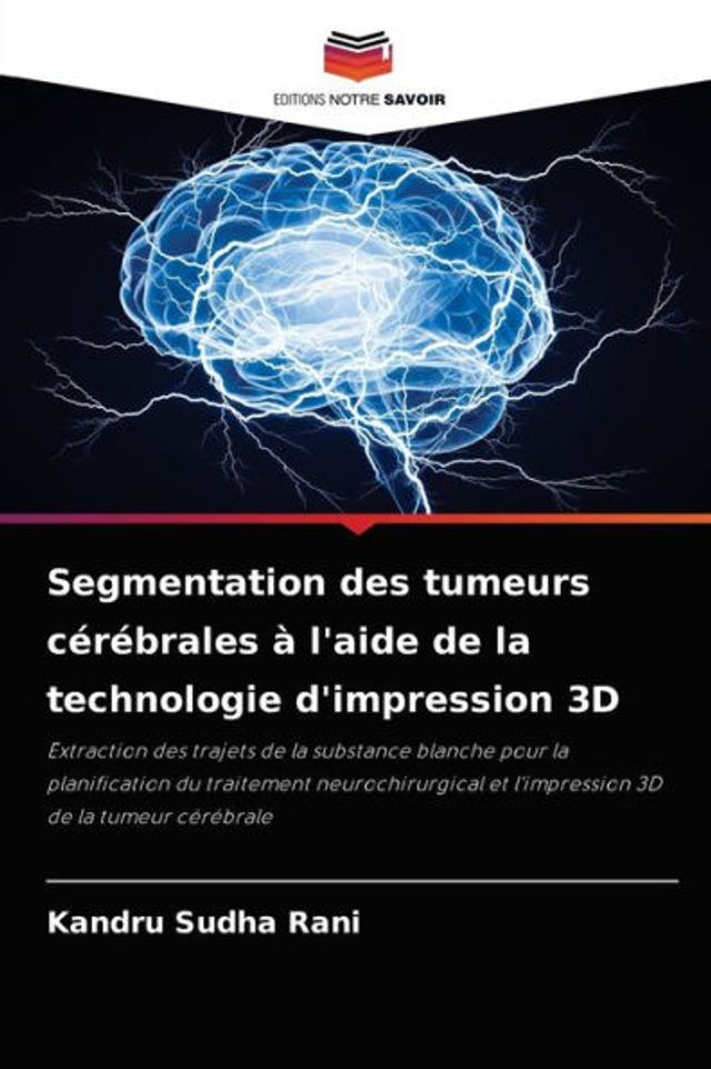 Segmentation des tumeurs cérébrales à l'aide de la technologie d'impression 3D