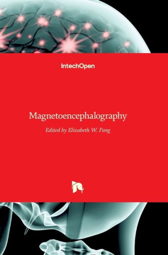 Magnetoencephalography