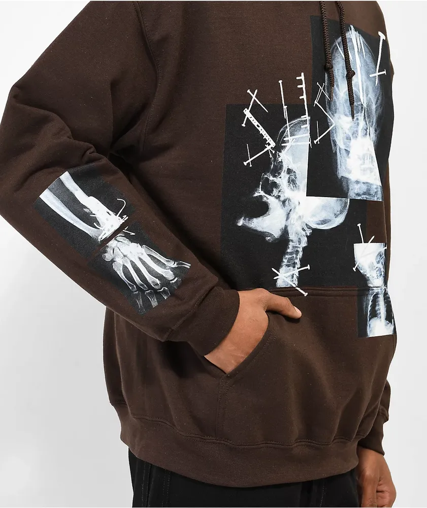 SUS BOY X-Ray Dark Brown Hoodie