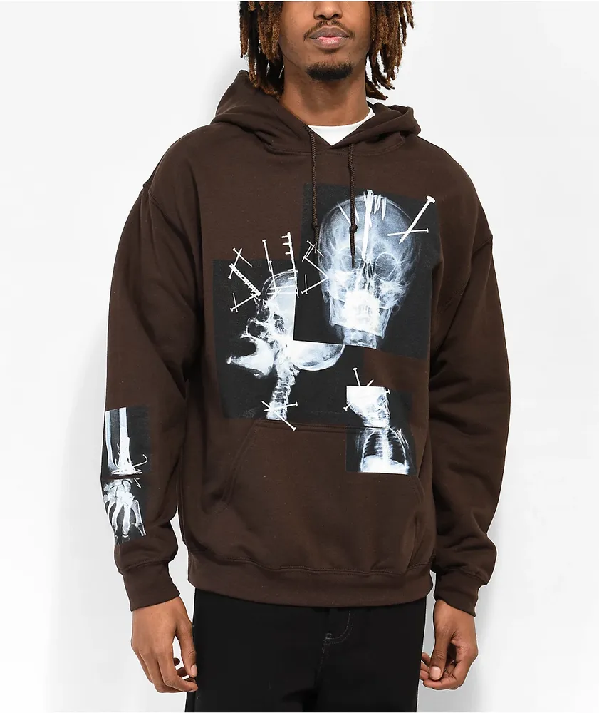 SUS BOY X-Ray Dark Brown Hoodie