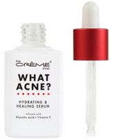 What Acne? Hydrating & Healing Serum