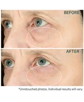 StriVectin Hyperlift Eye Instant Eye Fix