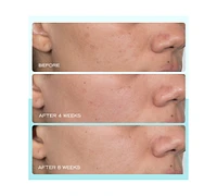 First Aid Beauty Dark Spot Serum With Niacinamide, 1 oz.