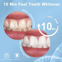 MySmile Teeth Whitening Kit for Sensitive Teeth with Led Light, 10 Min Non-Sensitive Fast Teeth Whitener, 3 22% Cp Teeth Whitening Gel, Enamel Safe