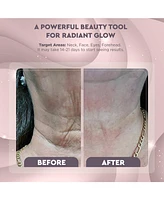 Skin Rejuvenation Led Beauty Device - Neck And Face 1 pc