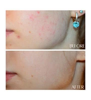 Botanicary No. 5 Recover