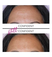 Undereye Firming Gel