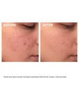 Clarins Beauty Flash Peel with Bha & Aha