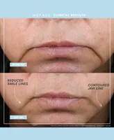 NuFACE 4-Pc. Mini+ Starter Set - Sandy Rose