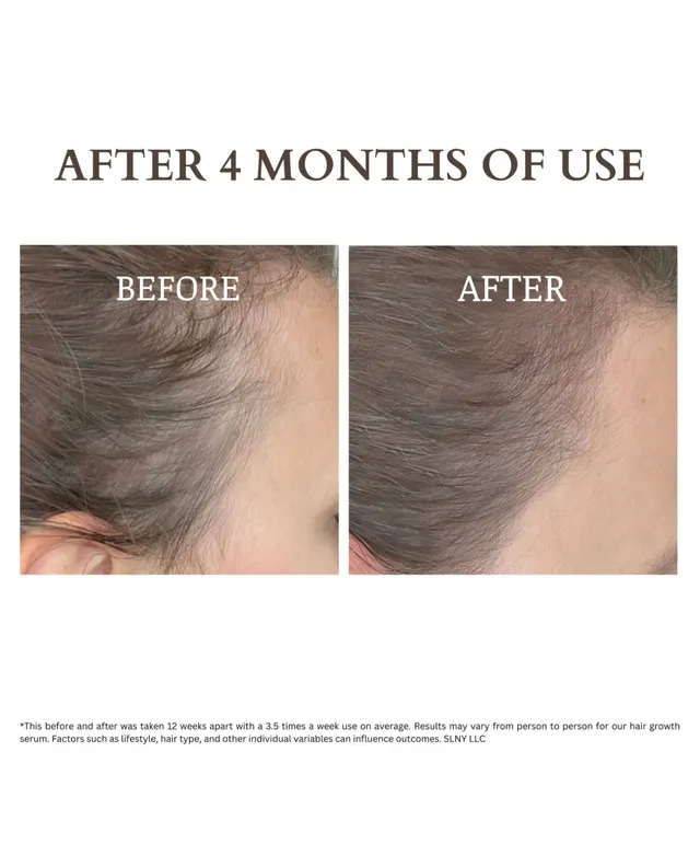 Hers Hair Regrowth Treatment - 2.11 oz